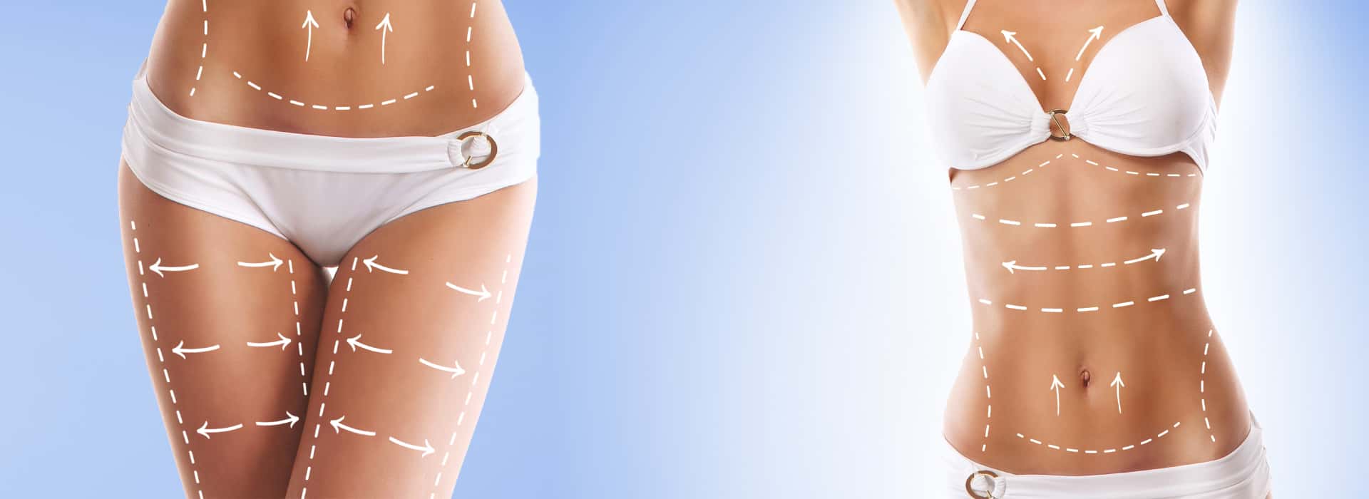 Mommy Makeover in UK Mcan Health London